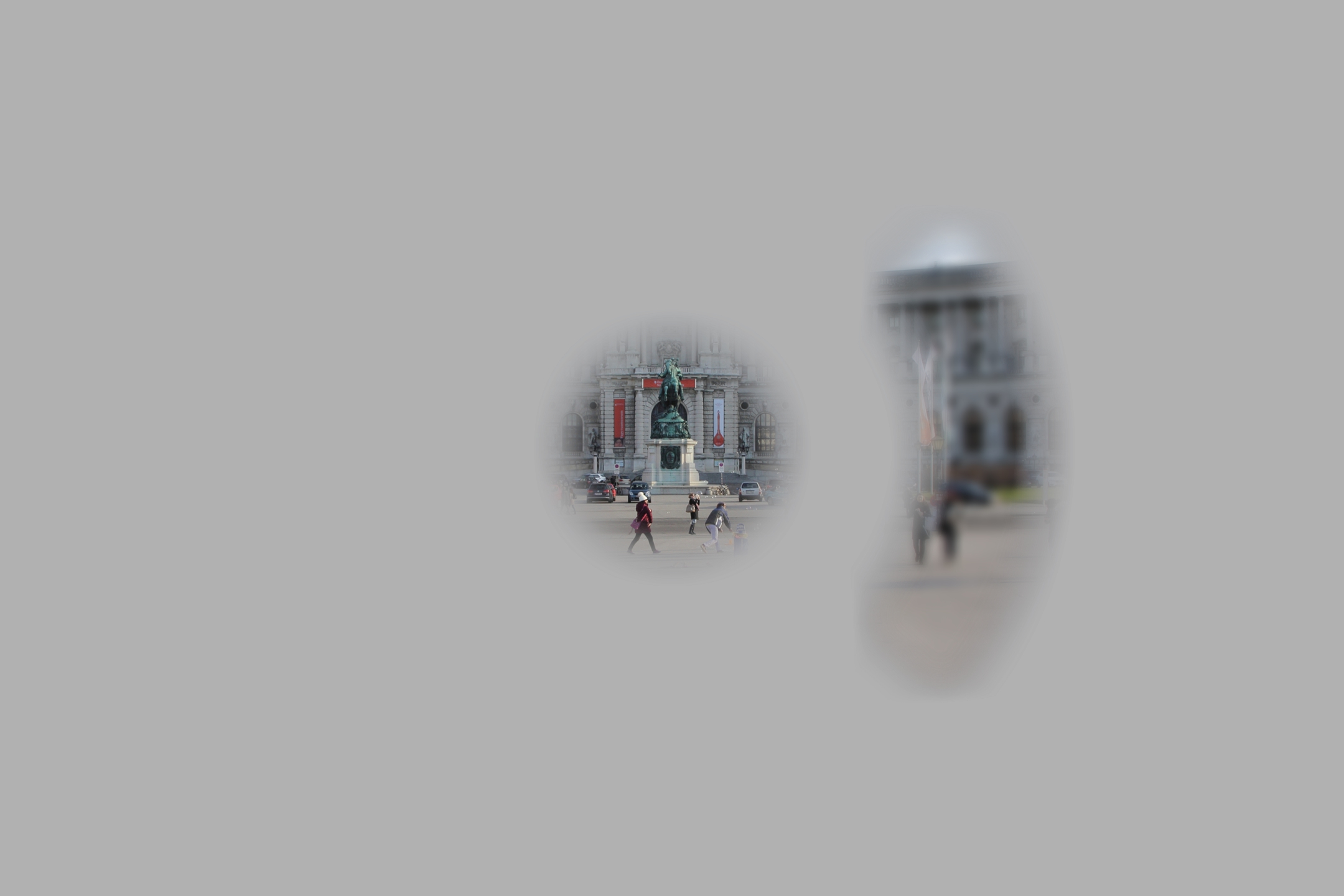 Hofburg Bild mit Glaukom mit Sichelaussparung