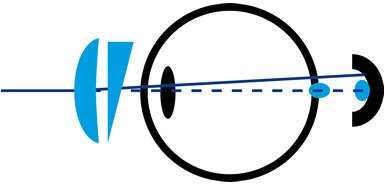 Darstellung einer Prismenverschiebung